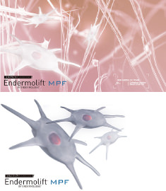 エンダモリフトイメージ